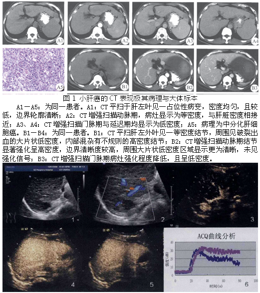 揭秘十二月十八日实时CT影像技术，医学视觉盛宴的回顾与前瞻展望